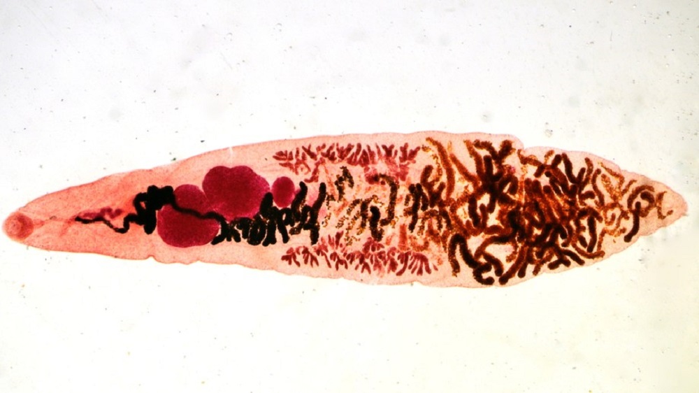 helminth flukes a pinworm légzőszervei